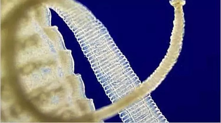 Seekor ikan nila ditemukan dalam organ tubuh pria di China