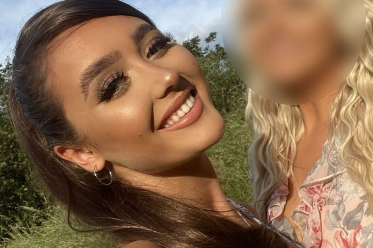 Olivia McCann (21) melakukan filler bibir yang malah membuat bibirnya membengkak