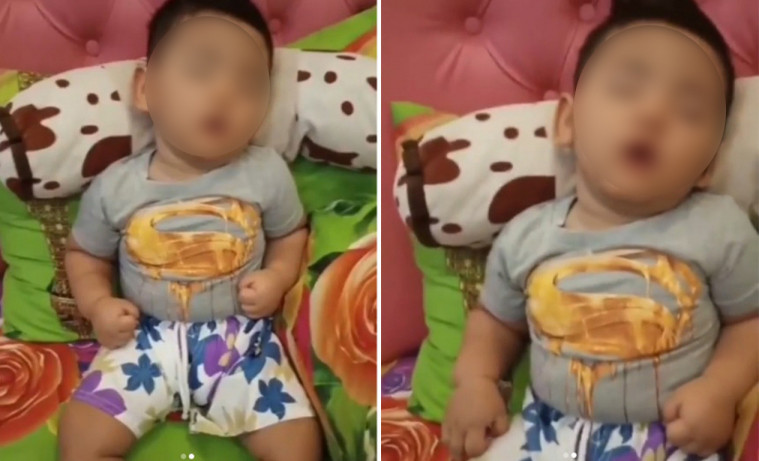 Shaka balita yang idap sindrom putri tidur