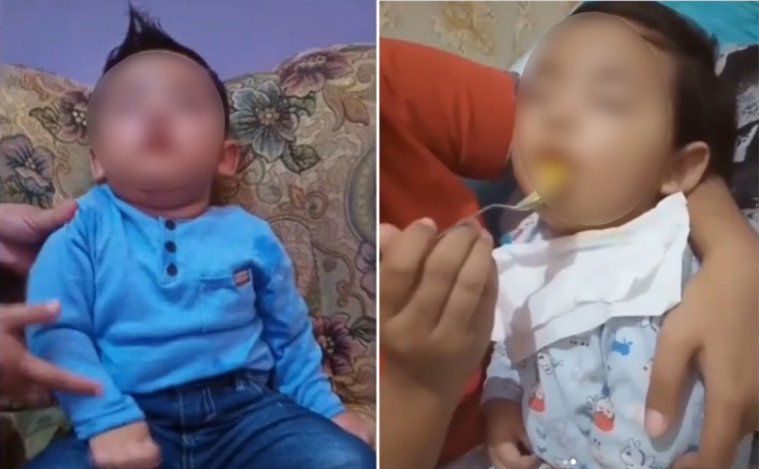 Shaka balita yang idap sindrom putri tidur
