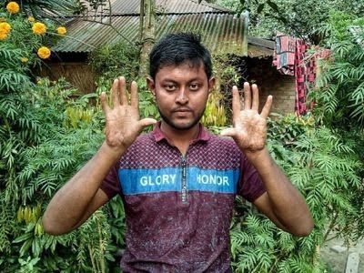 Ilustrasi telapak tangan