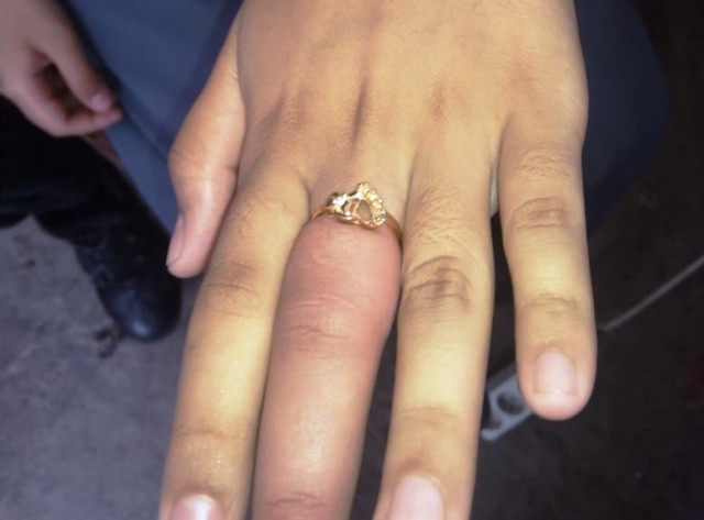 Ilustrasi gambar cincin yang tak bisa lepas