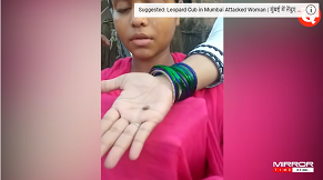 Gadis di India mengeluarkan batu-batu kecil dari matanya